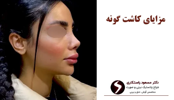 مزایای کاشت گونه مزایای کاشت گونه