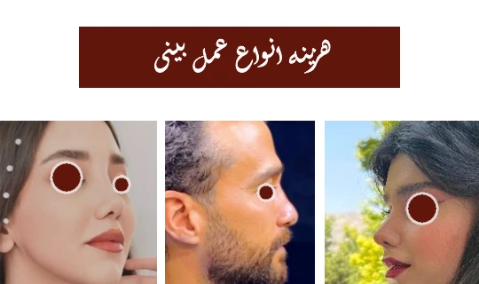 هزینه انواع جراحی بینی هزینه انواع جراحی بینی
