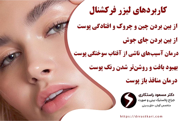 کاربردهای لیزر فرکشنال