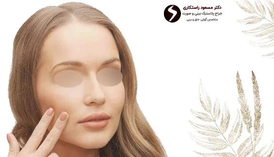 کاشت دائمی گونه کاشت دائمی گونه