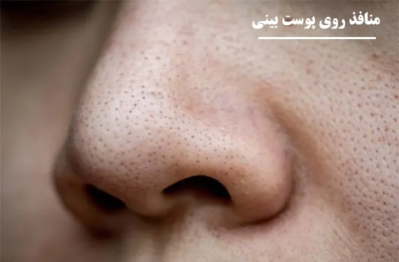 منافذ روی پوست بینی