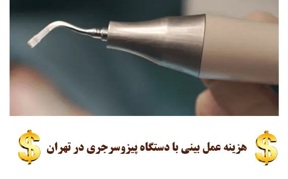 هزینه عمل بینی با دستگاه پیزوسرجری در تهران هزینه عمل بینی با دستگاه پیزوسرجری