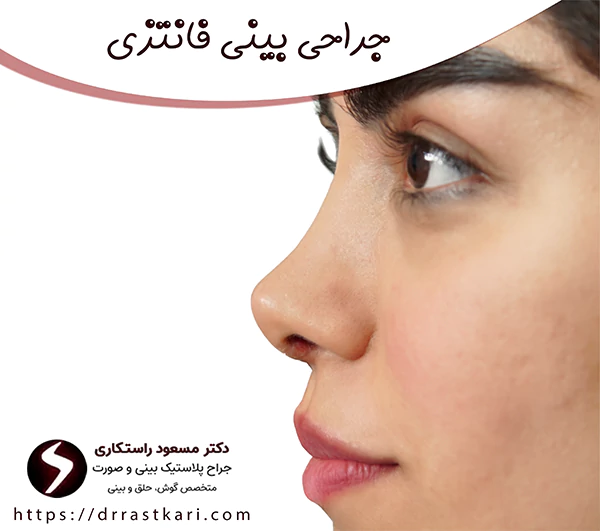 جراحی بینی فانتزی