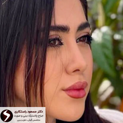 مزایای عمل بینی بدون تامپون