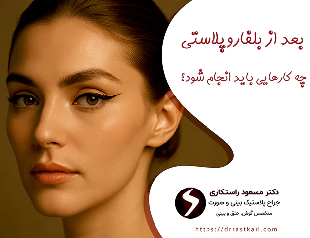بعد از بلفاروپلاستی بعد از بلفاروپلاستی
