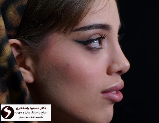 عمل بینی چیست؟ عمل بینی چیست؟