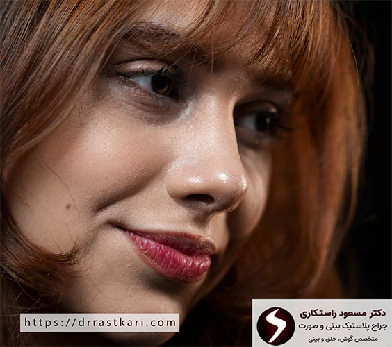 عکس نتیجه عمل بینی