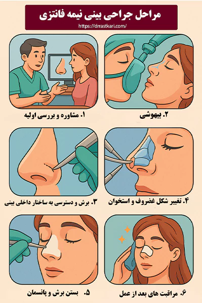 مراحل جراحی بینی نیمه فانتزی مراحل جراحی بینی نیمه فانتزی
