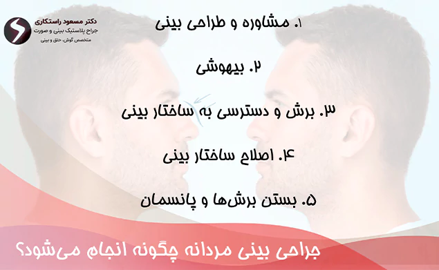 نحوه انجام جراحی بینی مردانه