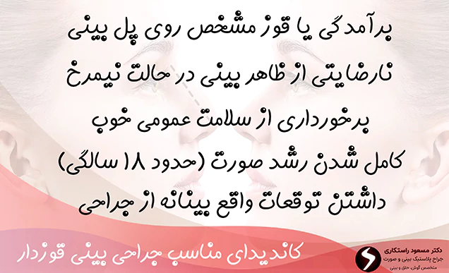 کاندیدای مناسب جراحی بینی قوزدار کاندیدای مناسب جراحی بینی قوزدار