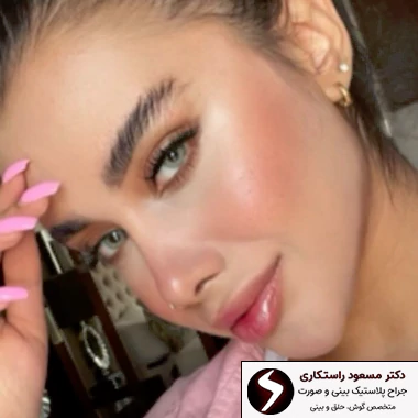 جراحی بینی در استانبول جراحی بینی در استانبول