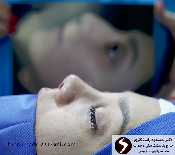 قبل و بعد جراحی شکستگی بینی