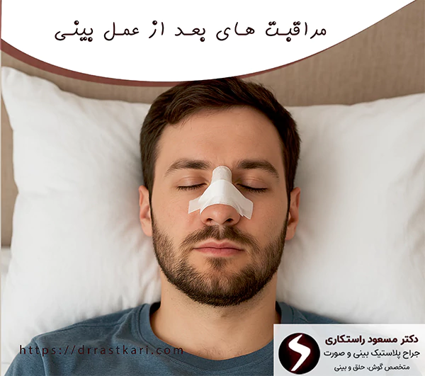 مراقبت های بعد از عمل بینی