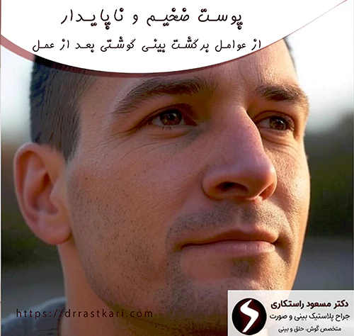 پوست ضخیم و ناپایدار