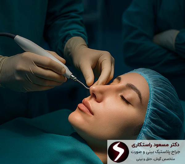 آیا جراحی بینی اولتراسونیک مورد تایید پزشکان است؟
