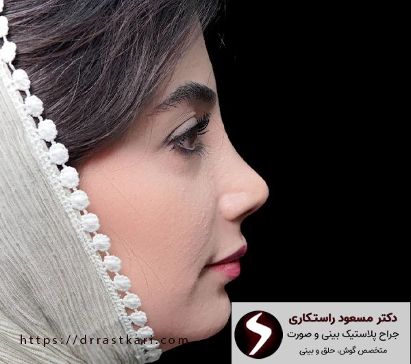 افراد مناسب جراحی بینی