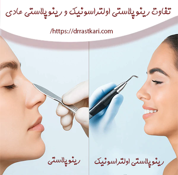 تفاوت-رینوپلاستی-اولتراسونیک-رینوپلاستی-عادی