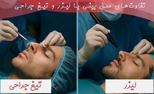 تفاوت‌ های عمل بینی با لیزر و تیغ جراحی