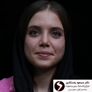 جراحی بینی مطابق با فرم صورت