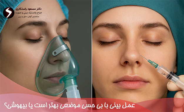 عمل بینی با بی حسی موضعی بهتر است یا بیهوشی؟ 