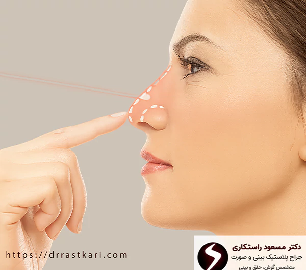 مزایای جراحی بینی با لیزر