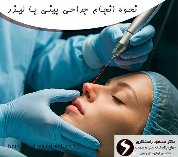 نحوه انجام جراحی بینی با لیزر