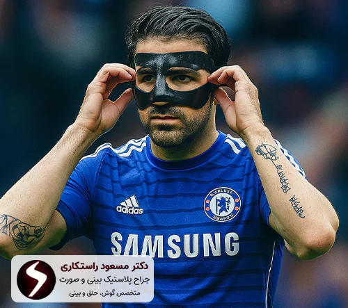 نیاز به استفاده از محافظ بینی بعد از جراحی در ورزشکاران