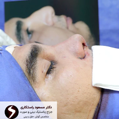 بینی استخوانی بینی استخوانی