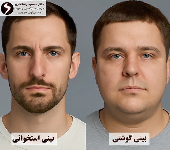 تفاوت بینی گوشتی و استخوانی در مزایا تفاوت بینی گوشتی و استخوانی در مزایا