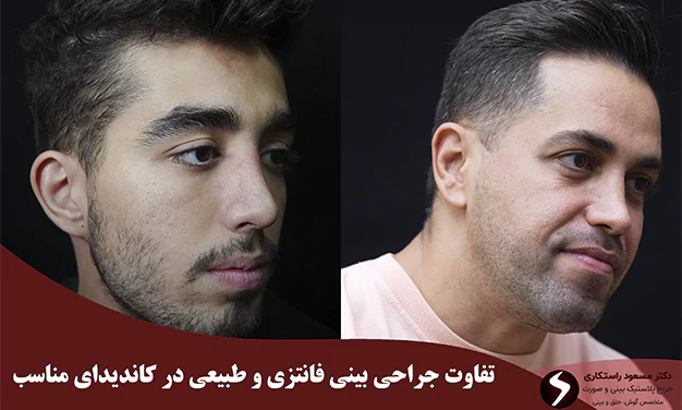 تفاوت جراحی بینی طبیعی و فانتزی در کاندیدای مناسب
