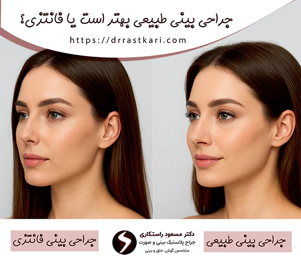 جراحی بینی طبیعی بهتر است یا فانتزی؟