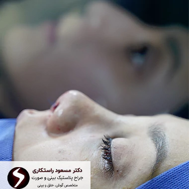 ظاهر بینی استخوانی ظاهر بینی استخوانی