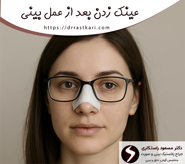 عینک زدن بعد از عمل بینی
