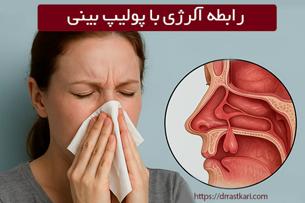 رابطه آلرژی با پولیپ بینی رابطه آلرژی با پولیپ بینی