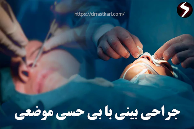 عمل بینی با بی حسی جراحی بینی با بی حسی موضعی