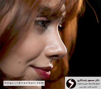 نتیجه عمل بینی ترمیمی دکتر مسعود راستکاری نتیجه عمل بینی ترمیمی دکتر مسعود راستکاری