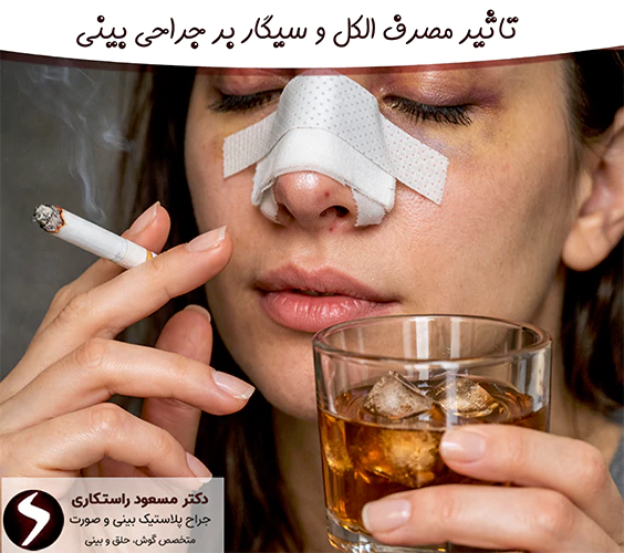 تاثیر مصرف الکل و سیگار بر جراحی بینی تاثیر مصرف الکل و سیگار بر جراحی بینی