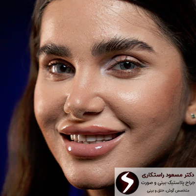 اهداف جراحی بینی