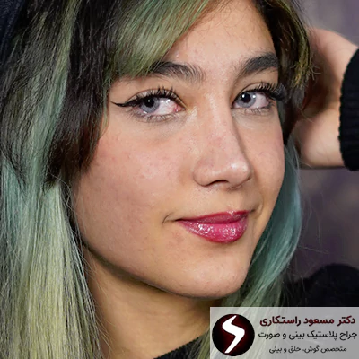 هدف از عمل بینی هدف از عمل بینی